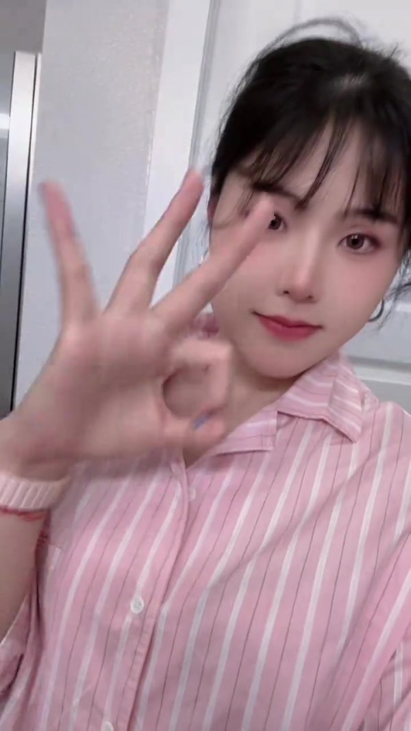 早日复健 小宝!养伤中的李月汝社媒:我对你下达了心动通缉令💖